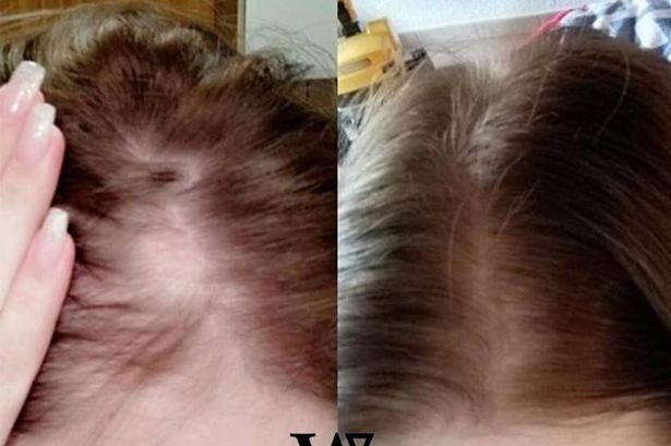 0 Watermans Hair growth shampoo