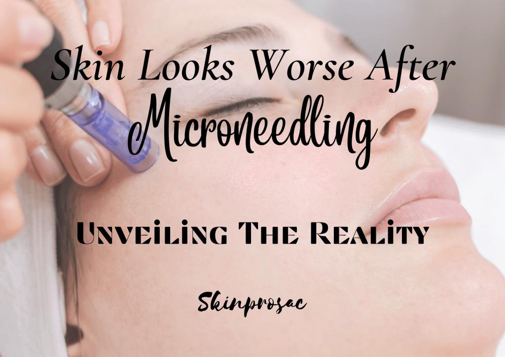 Skin Looks Worse After Microneedling