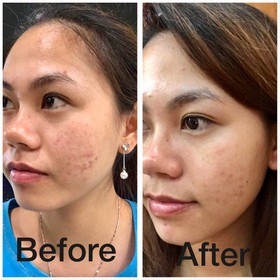 Kristals Cosmetics Rock Crystal Refining Moisturizer before and after