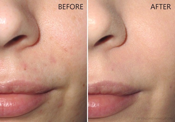 Lumiere Skin Serum before and after