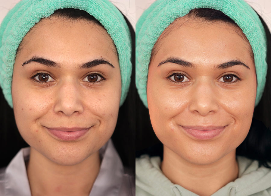 Milani Glow Hydrating Skin Tint before and after