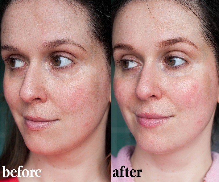Clinique CC Cream before and after