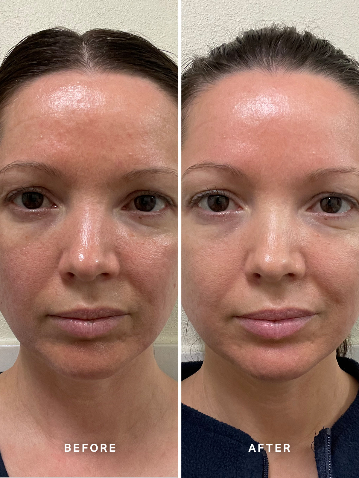 Good Molecules Niacinamide Serum Before and After