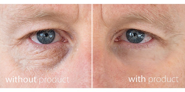 My Perfect Eyes before and after