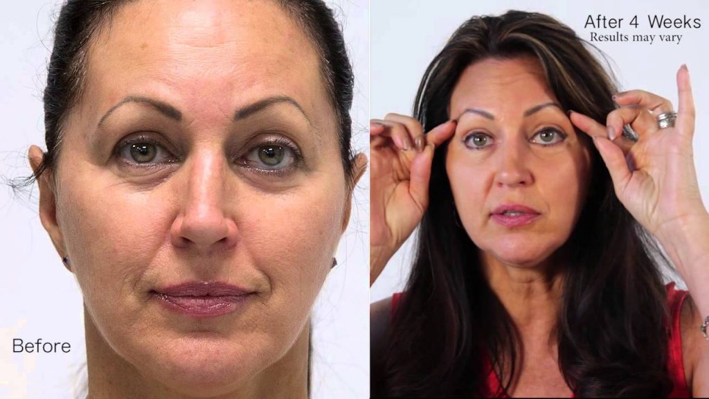 Beverly Hills Instant Facelift and eye serum before and after