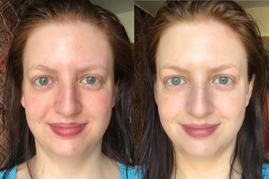 Skinceuticals Physical Fusion Uv Defense Spf 50 before and after