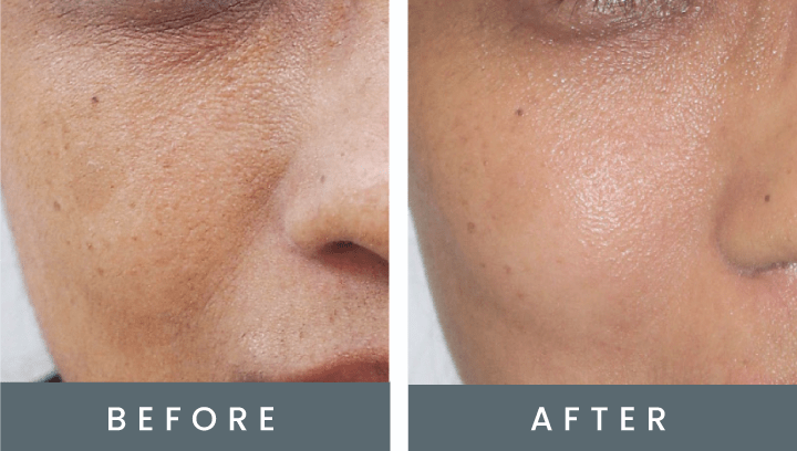 skinfix before and after