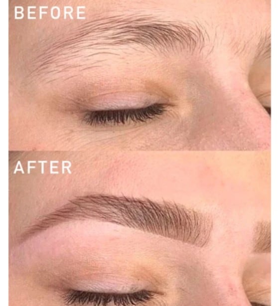 Flawless Brows before and after