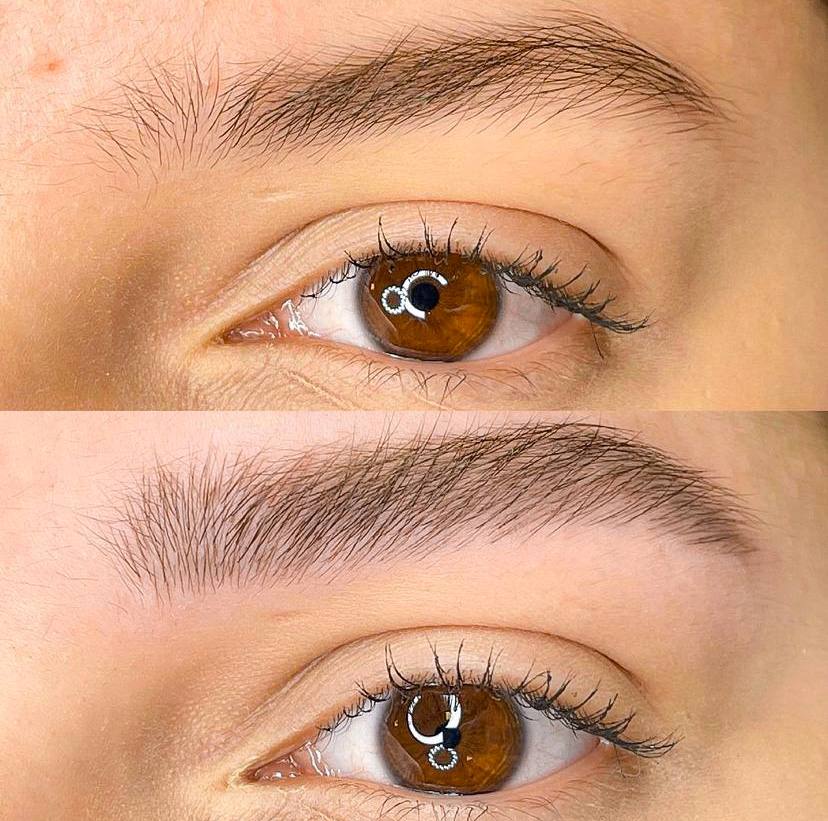Flawless Brows before and after
