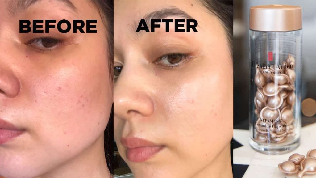 Youth Renew Ceramide before and after