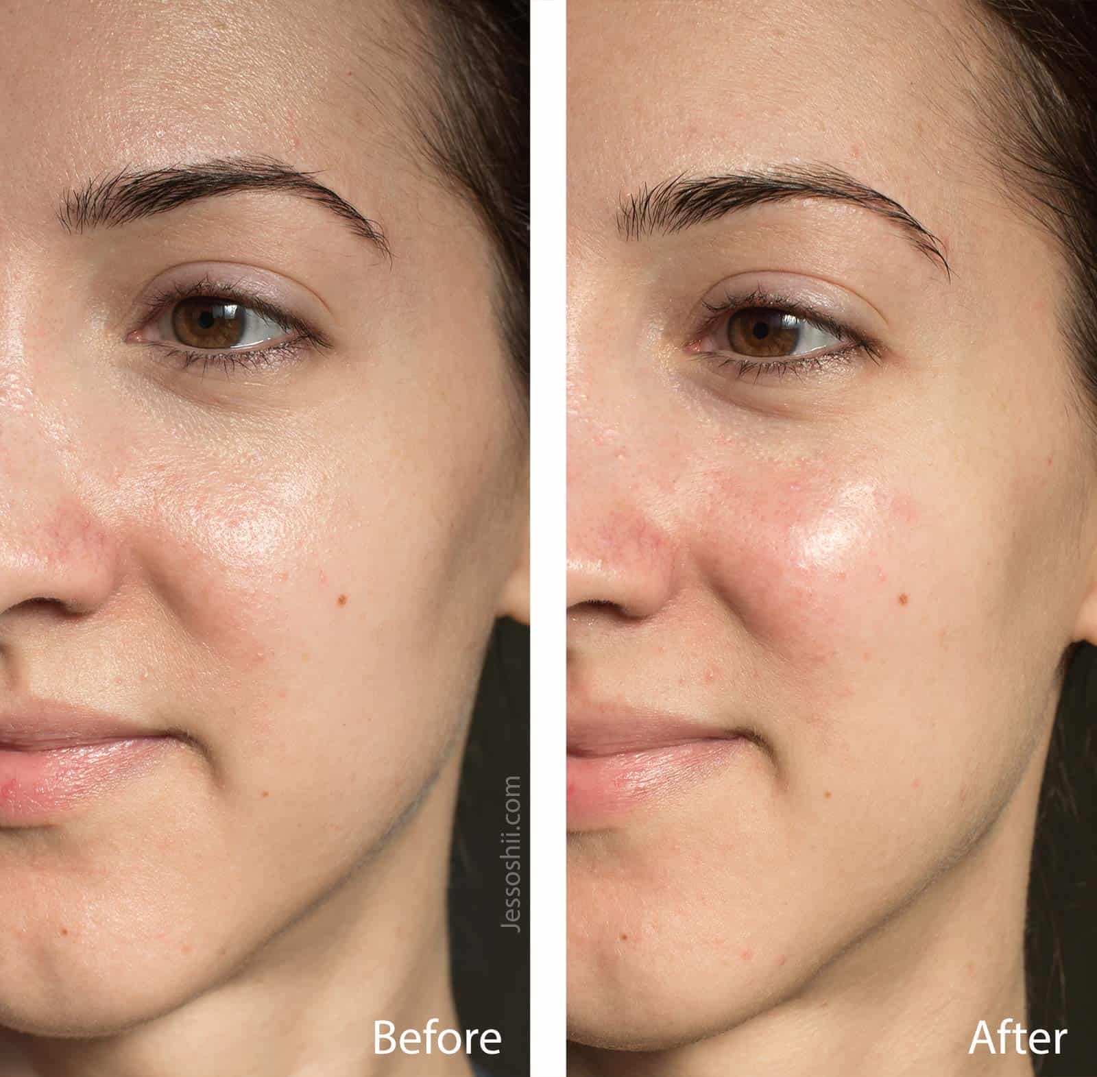 farmacy bright on vitamin c mask before after 9 1