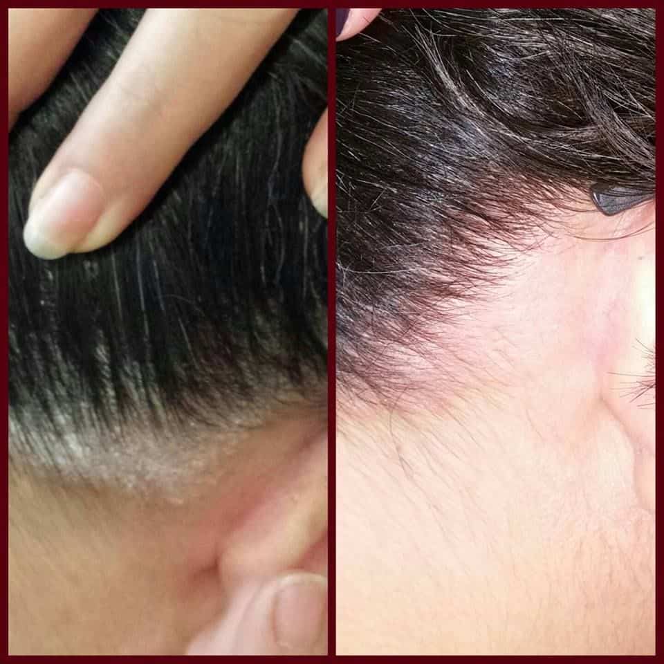 Monat Rejuvenique Oil Intensive before and after