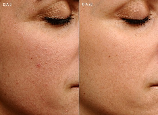 Radiant Fused Anti-Aging Cream before and after