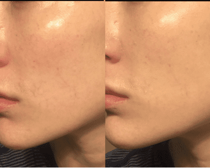 Stila One Step Corrector Before and After