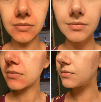 Stila One Step Correct Before and After