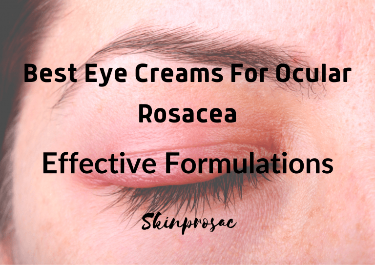 Best Eye Cream For Ocular Rosacea