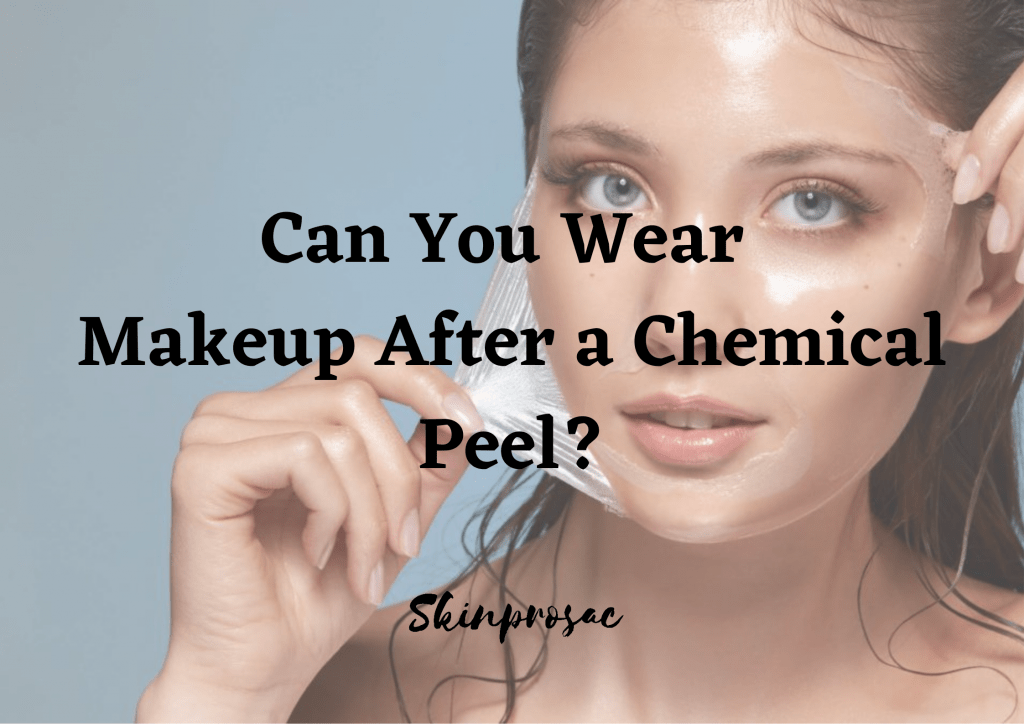Can You Wear Makeup After a Chemical Peel?