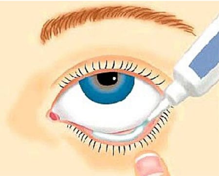 How To Apply Erythromycin To Your Eye Correctly?